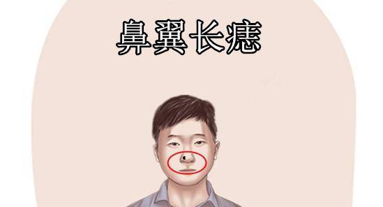 鼻梁上有痣代表什么？左鼻翼有一颗痣有福