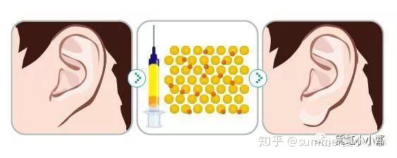 耳朵在颜值里的地位就像一个坐在角落里